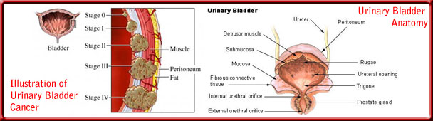 urinary_bladder_cancer_toppanel