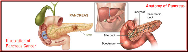 pancreas_cancer_toppanel